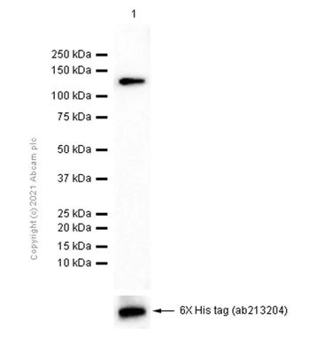 Western blot - Anti-Aggrecan antibody [6-B-4] (AB3778)