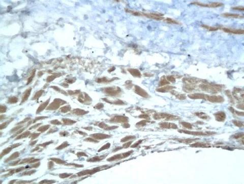 Immunohistochemistry (Formalin/PFA-fixed paraffin-embedded sections) - Anti-Aggrecan antibody (AB216965)