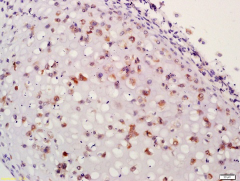 Immunohistochemistry (Formalin/PFA-fixed paraffin-embedded sections) - Anti-Aggrecan antibody (AB216965)