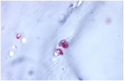 Immunohistochemistry (Formalin/PFA-fixed paraffin-embedded sections) - Anti-Aggrecan antibody - C-terminal (AB140691)