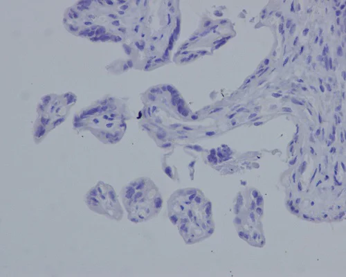 Immunohistochemistry (Formalin/PFA-fixed paraffin-embedded sections) - Anti-Aggrecan antibody [EPR14664] (AB186414)