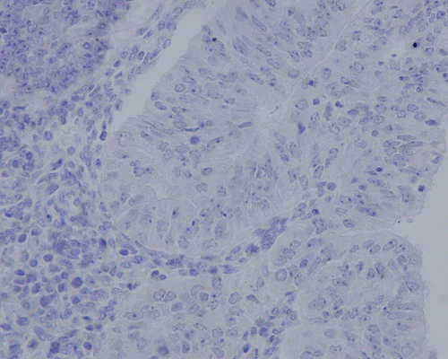 Immunohistochemistry (Formalin/PFA-fixed paraffin-embedded sections) - Anti-Aggrecan antibody [EPR14664] - BSA and Azide free (AB232628)