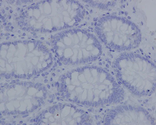 Immunohistochemistry (Formalin/PFA-fixed paraffin-embedded sections) - Anti-Aggrecan antibody [EPR14664] - BSA and Azide free (AB232628)