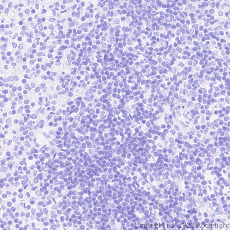 Immunohistochemistry (Formalin/PFA-fixed paraffin-embedded sections) - Anti-Aggrecan antibody [EPR28034-86] (AB313636)