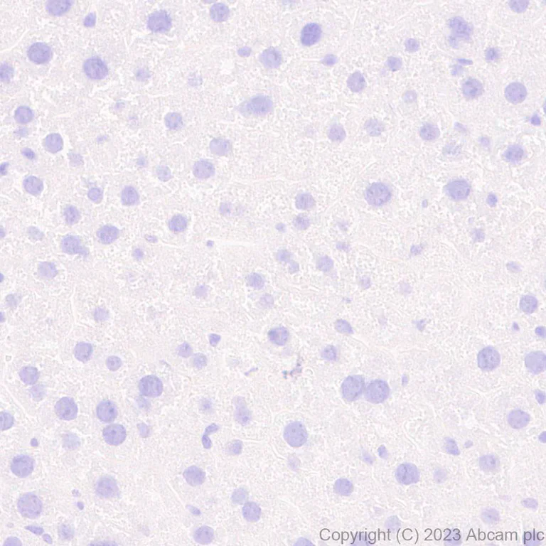 Immunohistochemistry (Formalin/PFA-fixed paraffin-embedded sections) - Anti-Aggrecan antibody [EPR28034-86] (AB313636)