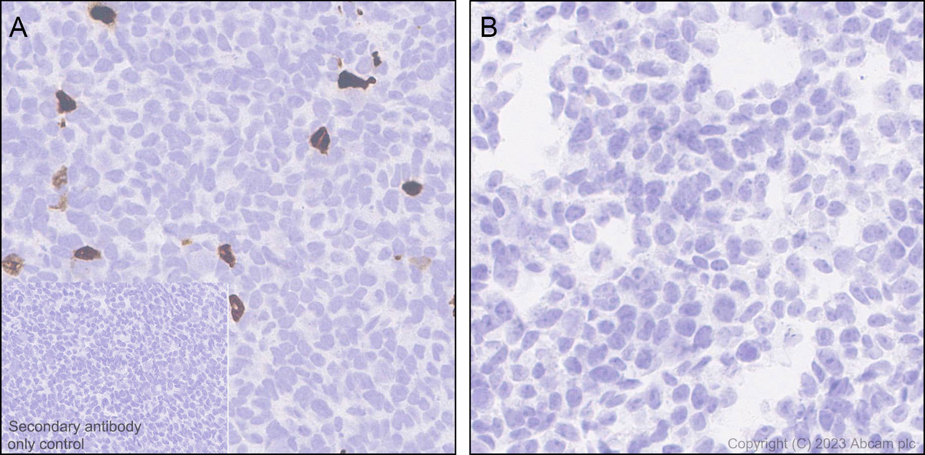 Immunohistochemistry (Formalin/PFA-fixed paraffin-embedded sections) - Anti-Aggrecan antibody [EPR28034-86] (AB313636)