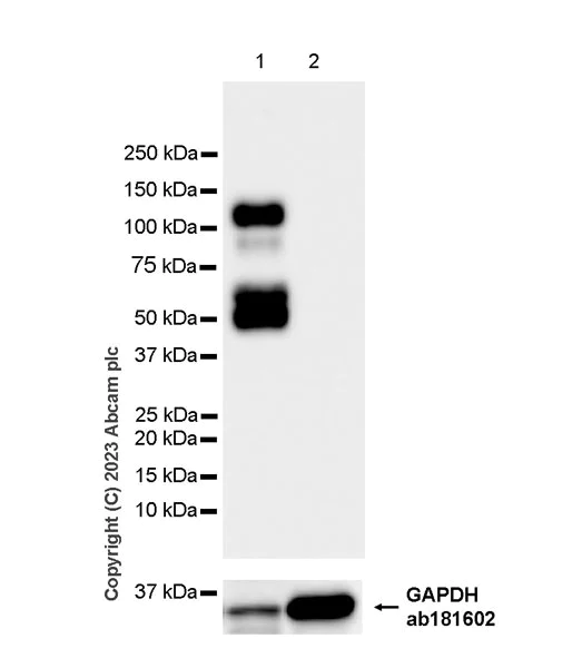 Western blot - Anti-Aggrecan antibody [EPR28034-86] (AB313636)
