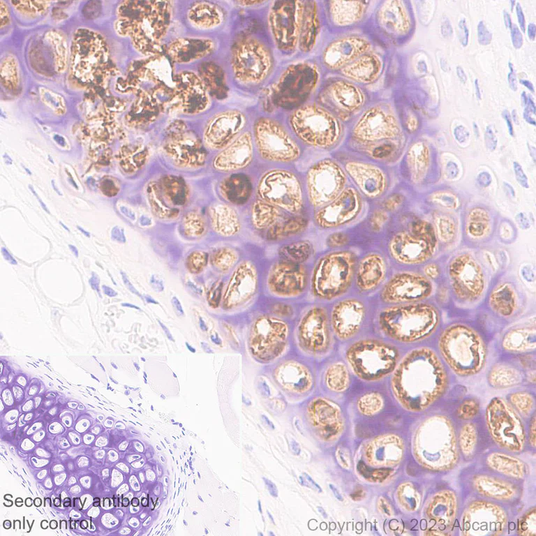 Immunohistochemistry (Formalin/PFA-fixed paraffin-embedded sections) - Anti-Aggrecan antibody [EPR28034-86] - BSA and Azide free (AB313637)