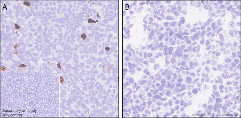 Immunohistochemistry (Formalin/PFA-fixed paraffin-embedded sections) - Anti-Aggrecan antibody [EPR28034-86] - BSA and Azide free (AB313637)