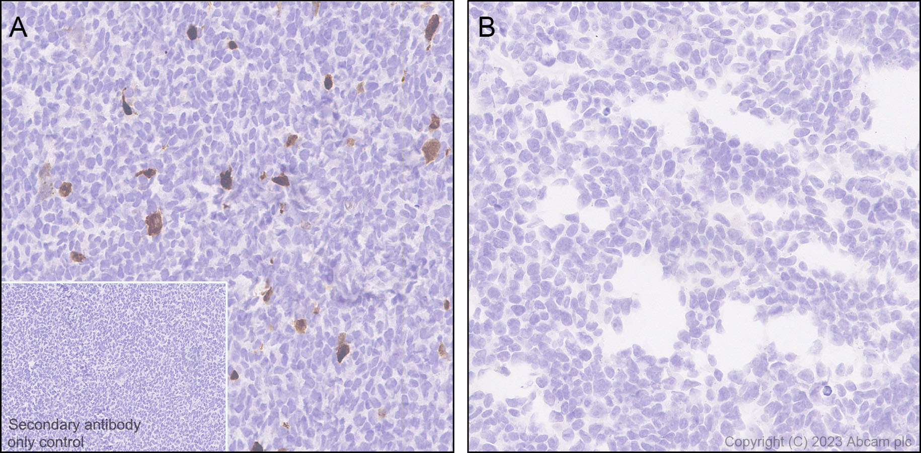 Immunohistochemistry (Formalin/PFA-fixed paraffin-embedded sections) - Anti-Aggrecan antibody [RM2036] (AB315486)
