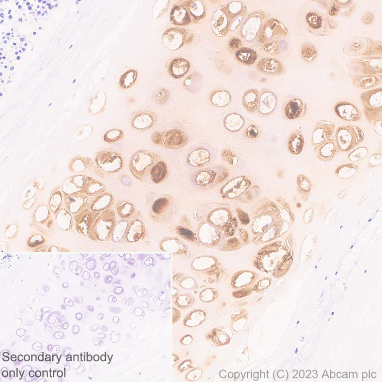 Immunohistochemistry (Formalin/PFA-fixed paraffin-embedded sections) - Anti-Aggrecan antibody [RM2036] - BSA and Azide free (AB315487)