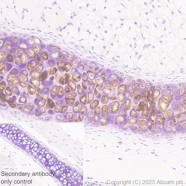 Immunohistochemistry (Formalin/PFA-fixed paraffin-embedded sections) - Anti-Aggrecan antibody [RM2036] - BSA and Azide free (AB315487)