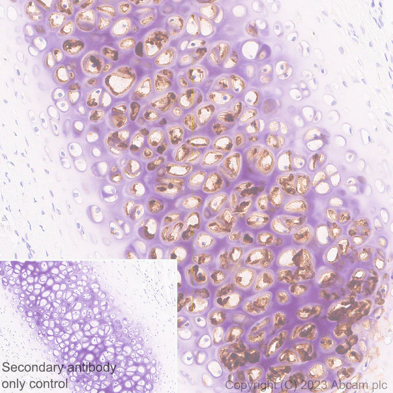 Immunohistochemistry (Formalin/PFA-fixed paraffin-embedded sections) - Anti-Aggrecan antibody [RM2036] - BSA and Azide free (AB315487)