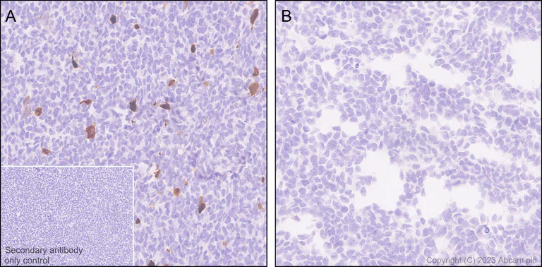 Immunohistochemistry (Formalin/PFA-fixed paraffin-embedded sections) - Anti-Aggrecan antibody [RM2036] - BSA and Azide free (AB315487)