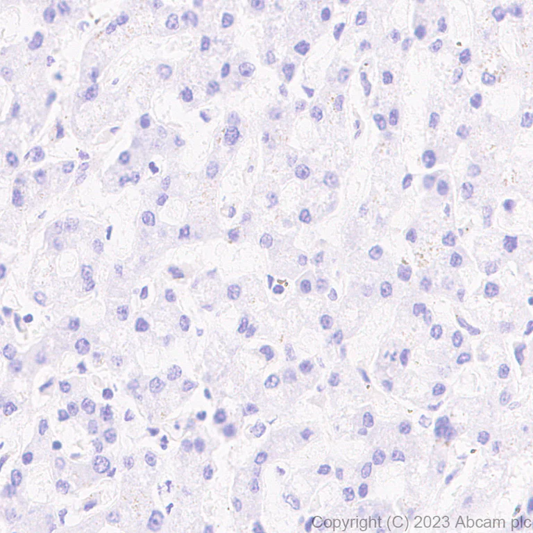 Immunohistochemistry (Formalin/PFA-fixed paraffin-embedded sections) - Anti-Aggrecan antibody [RM2036] - BSA and Azide free (AB315487)