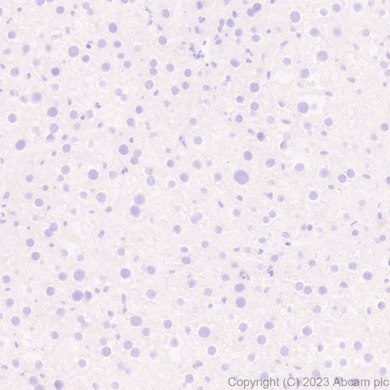 Immunohistochemistry (Formalin/PFA-fixed paraffin-embedded sections) - Anti-Aggrecan antibody [RM2036] - BSA and Azide free (AB315487)