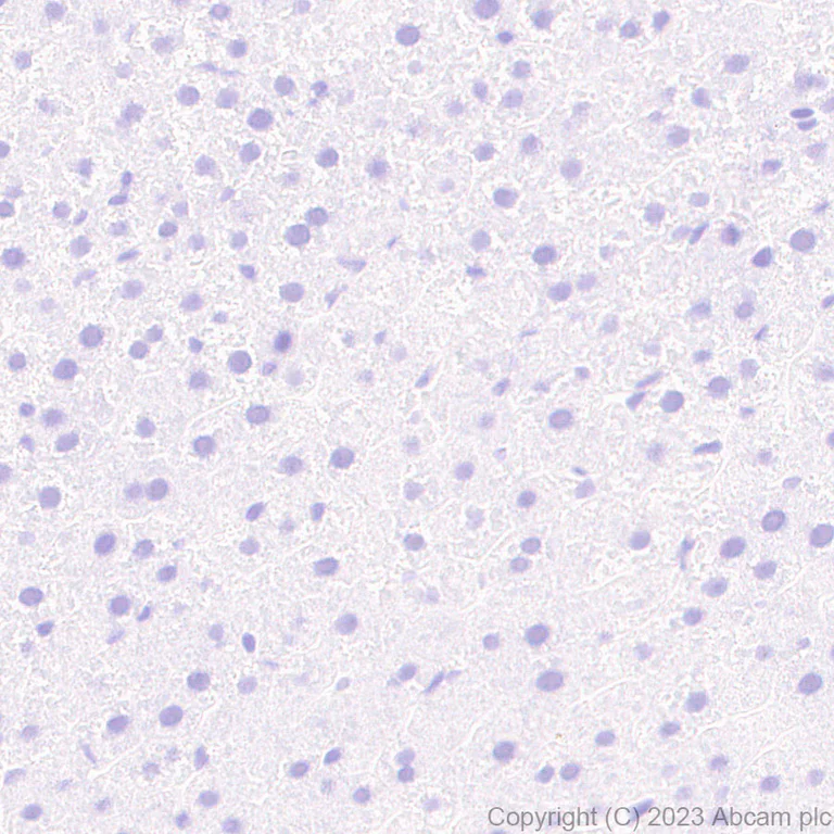 Immunohistochemistry (Formalin/PFA-fixed paraffin-embedded sections) - Anti-Aggrecan antibody [RM2036] - BSA and Azide free (AB315487)
