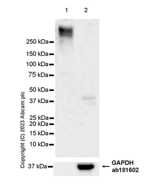 Western blot - Anti-Aggrecan antibody [RM2036] - BSA and Azide free (AB315487)