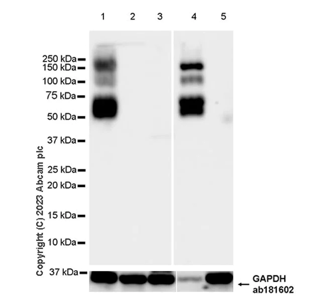 Western blot - Anti-Aggrecan antibody [RM2036] - BSA and Azide free (AB315487)