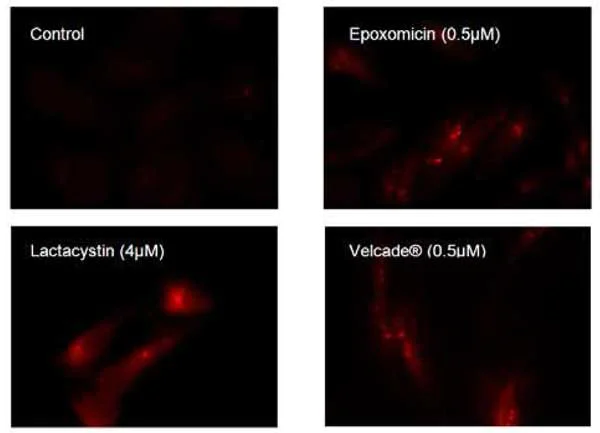 Fluorescence Microscopy - Aggresome Detection Kit (AB139486)