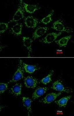 Immunocytochemistry/ Immunofluorescence - Anti-AGK antibody (AB137616)