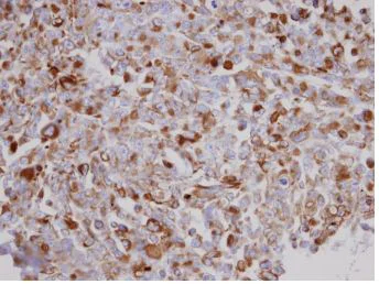Immunohistochemistry (Formalin/PFA-fixed paraffin-embedded sections) - Anti-AGK antibody (AB137616)