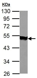 Western blot - Anti-AGK antibody (AB137616)