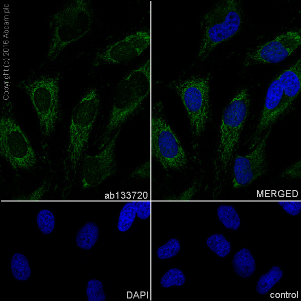 Immunocytochemistry/ Immunofluorescence - Anti-AGL/Alpha-glucosidase antibody [EPR8880] (ab133720), expandable thumbnail