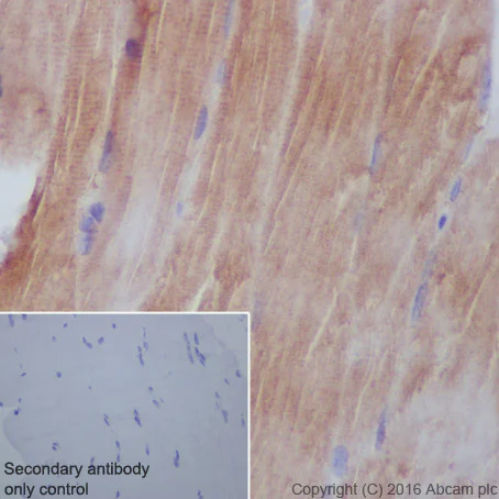 Immunohistochemistry (Formalin/PFA-fixed paraffin-embedded sections) - Anti-AGL/Alpha-glucosidase antibody [EPR8880] (AB133720)
