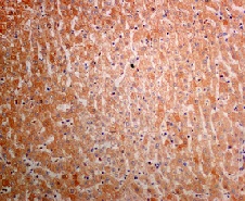 Immunohistochemistry (Formalin/PFA-fixed paraffin-embedded sections) - Anti-AGL/Alpha-glucosidase antibody [EPR8880] (ab133720), expandable thumbnail