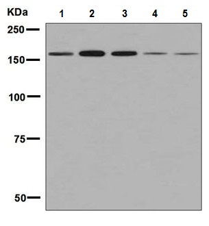 Western blot - Anti-AGL/Alpha-glucosidase antibody [EPR8880] (ab133720), expandable thumbnail