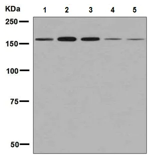 Western blot - Anti-AGL/Alpha-glucosidase antibody [EPR8880] (AB133720)