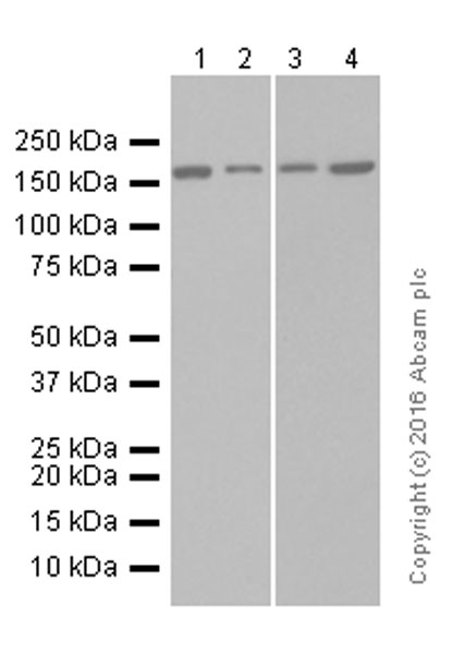 Western blot - Anti-AGL/Alpha-glucosidase antibody [EPR8880] (AB133720), expandable thumbnail