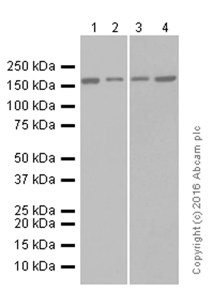 Western blot - Anti-AGL/Alpha-glucosidase antibody [EPR8880] (AB133720)