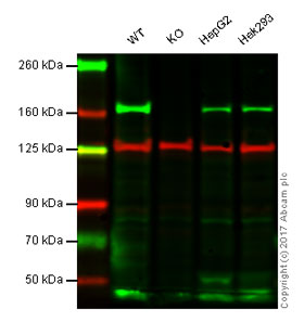Western blot - Anti-AGL/Alpha-glucosidase antibody [EPR8880] (ab133720), expandable thumbnail