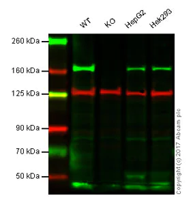 Western blot - Anti-AGL/Alpha-glucosidase antibody [EPR8880] (AB133720)
