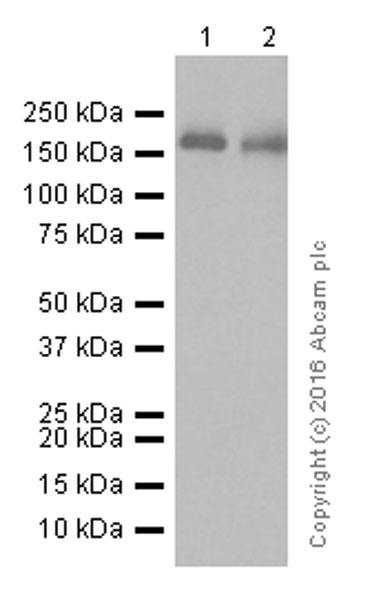 Western blot - Anti-AGL/Alpha-glucosidase antibody [EPR8880] (AB133720), expandable thumbnail