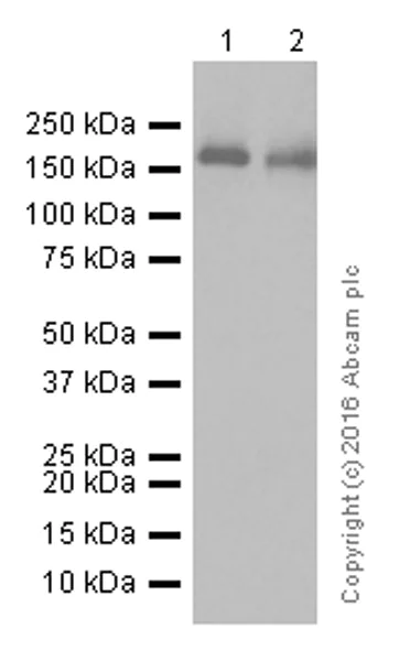Western blot - Anti-AGL/Alpha-glucosidase antibody [EPR8880] (AB133720)