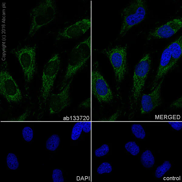 Immunocytochemistry/ Immunofluorescence - Anti-AGL/Alpha-glucosidase antibody [EPR8880] - BSA and Azide free (AB230798)