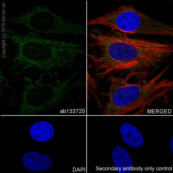 Immunocytochemistry/ Immunofluorescence - Anti-AGL/Alpha-glucosidase antibody [EPR8880] - BSA and Azide free (AB230798)
