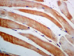 Immunohistochemistry (Formalin/PFA-fixed paraffin-embedded sections) - Anti-AGL/Alpha-glucosidase antibody [EPR8880] - BSA and Azide free (AB230798)