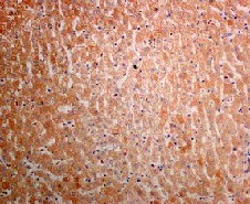 Immunohistochemistry (Formalin/PFA-fixed paraffin-embedded sections) - Anti-AGL/Alpha-glucosidase antibody [EPR8880] - BSA and Azide free (AB230798)