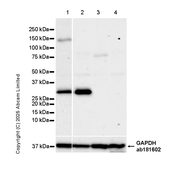 Western blot - Anti-AGMAT antibody [EPR30229-20] (AB325541)