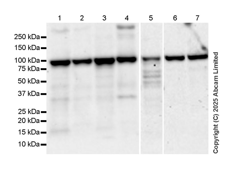 Western blot - Anti-AGO1 + AGO2 + AGO3 + AGO4 antibody  [RM1196] (AB323834), expandable thumbnail