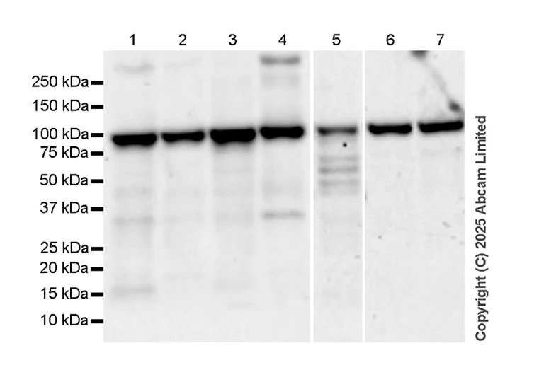 Western blot - Anti-AGO1 + AGO2 + AGO3 + AGO4 antibody [RM1196] (AB323834)