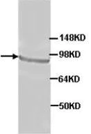 Western blot - Anti-AGO4 antibody (AB85077)