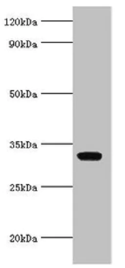 Western blot - Anti-AGPAT1 antibody (AB235328)