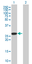 Western blot - Anti-AGPAT1 antibody (AB67018)