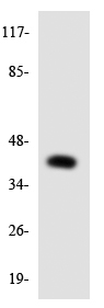 Western blot - Anti-AGPAT3 antibody (AB135887)