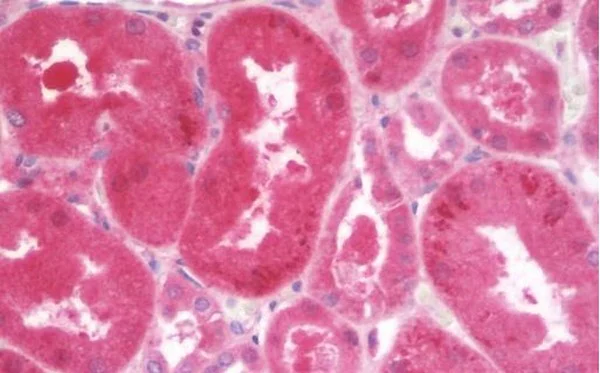 Immunohistochemistry (Formalin/PFA-fixed paraffin-embedded sections) - Anti-AGPAT3 antibody (AB211435)